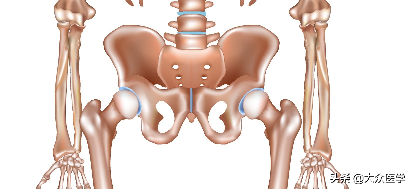 3d打印骨盆成功案例,3d打印肿瘤技术视频