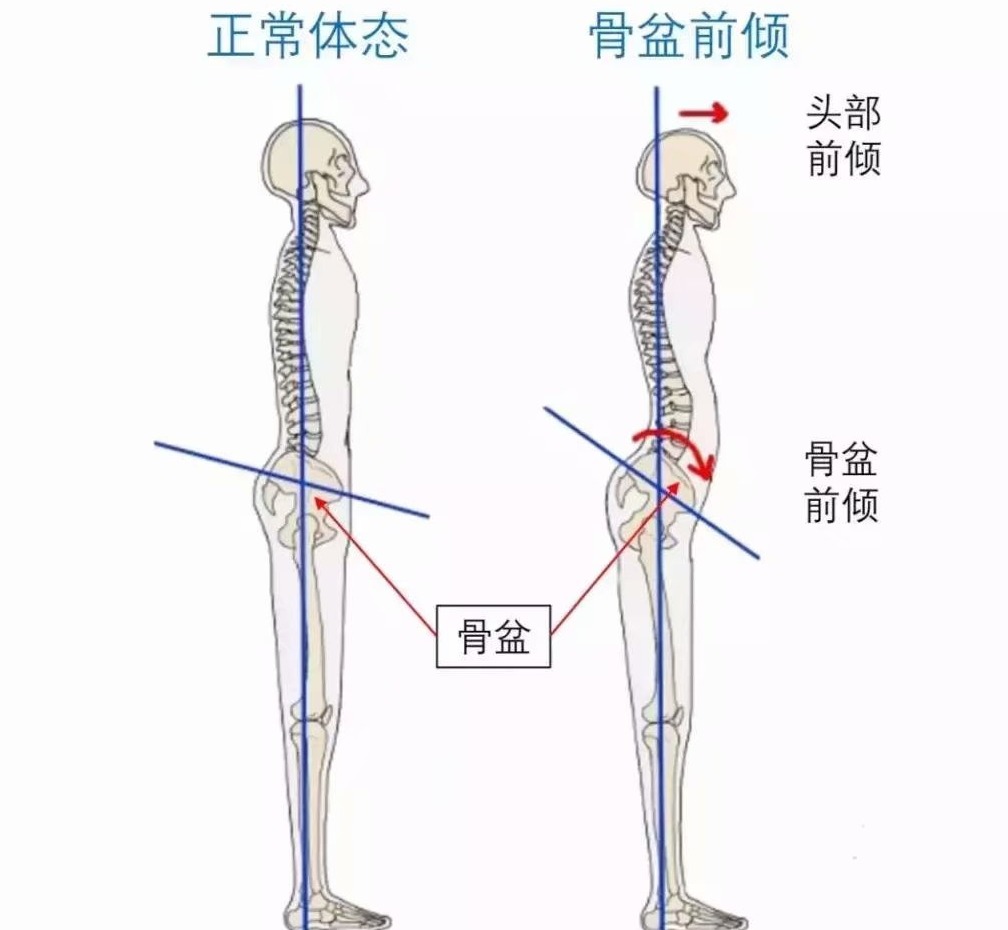 扁平足穿什么鞋都痛吗,扁平足穿什么鞋可以矫正