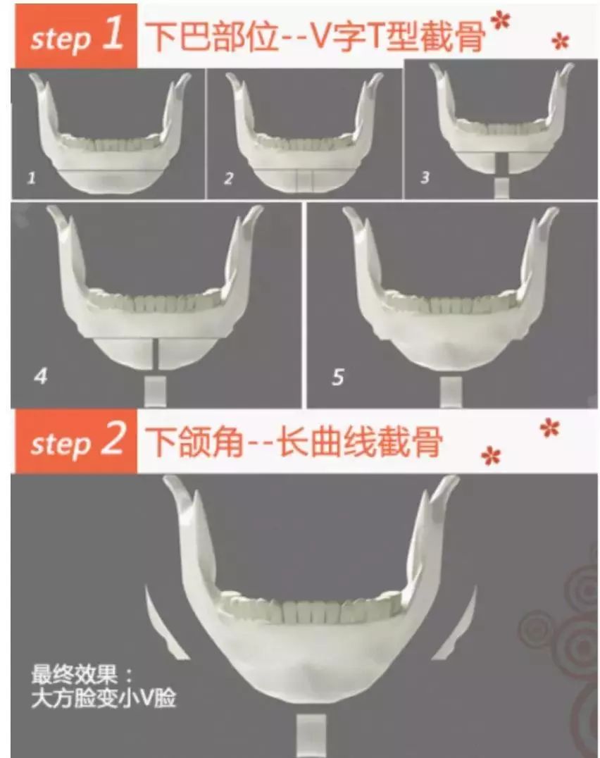 高圆圆方脸为什么那么好看,高圆圆方脸适合什么样鼻型