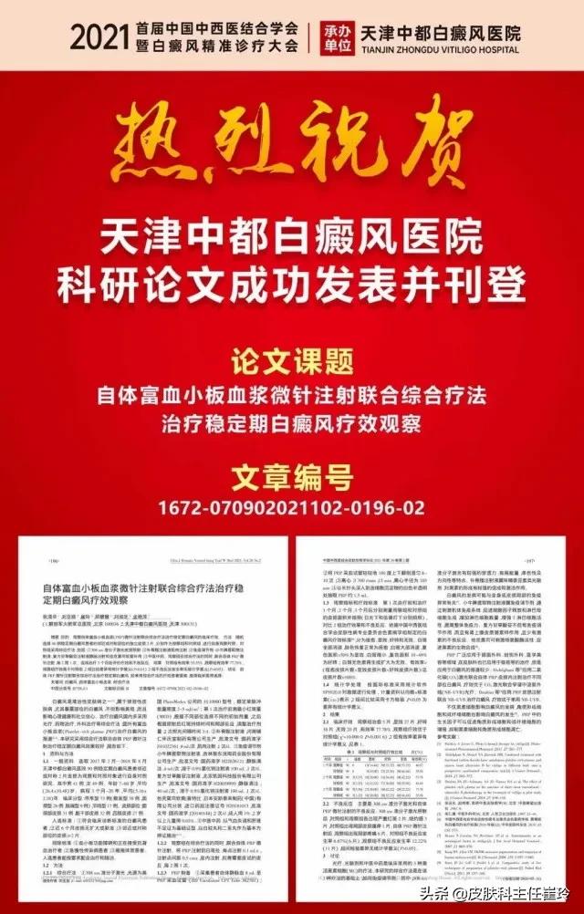 天津中都白癜风医院评价,中都白癜风医院天津