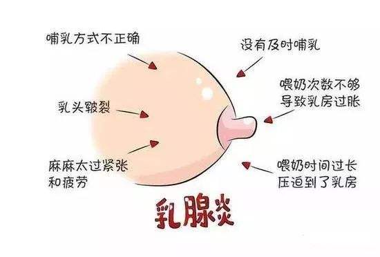哺乳期堵奶了自己在家怎么疏通,宝妈月子里堵奶高烧用酒精擦身