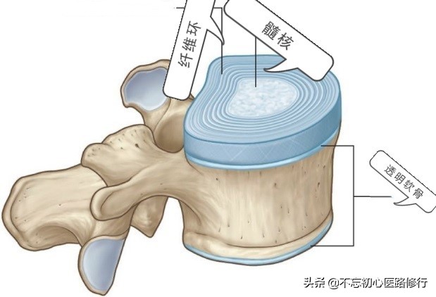 治疗腰椎间盘突出的方法与思路,腰椎间盘突出腰腿酸痛多久能好