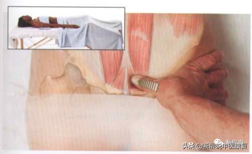 妇科盆腔疼痛症,盆腔筋膜炎如何彻底治愈