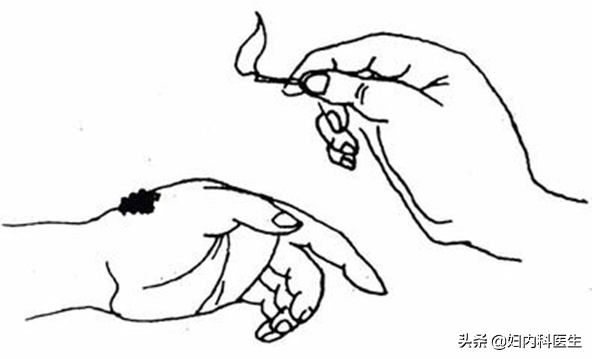 网友被毒蛇咬伤自救,被毒蛇咬伤如何自救原视频