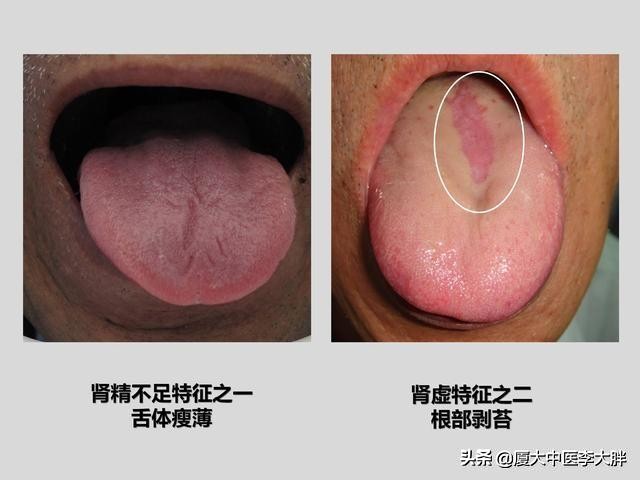 激情过后总是尿频、腰酸，这到底是不是肾虚，该怎么调理？