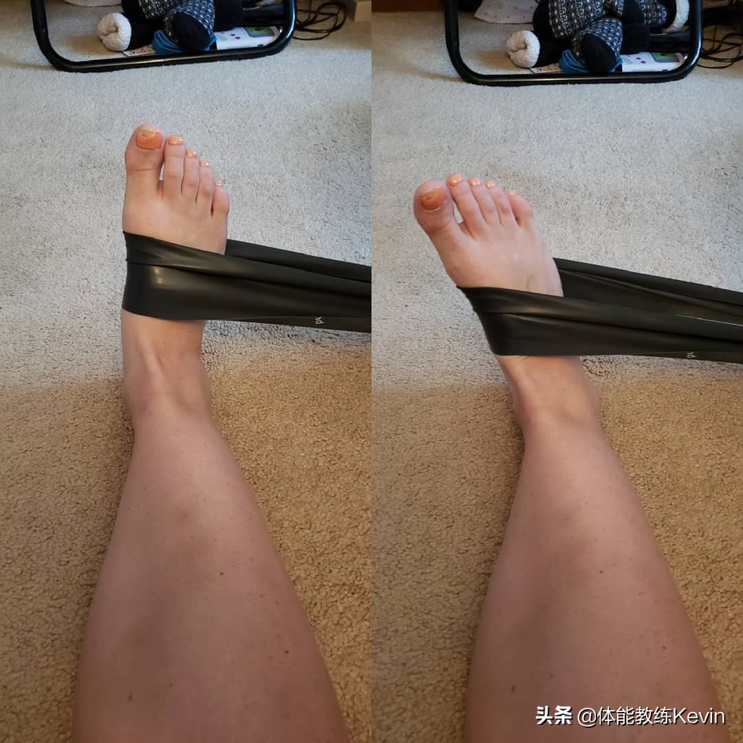 小儿足外翻康复训练弹力绷带,儿童足外翻康复训练教程