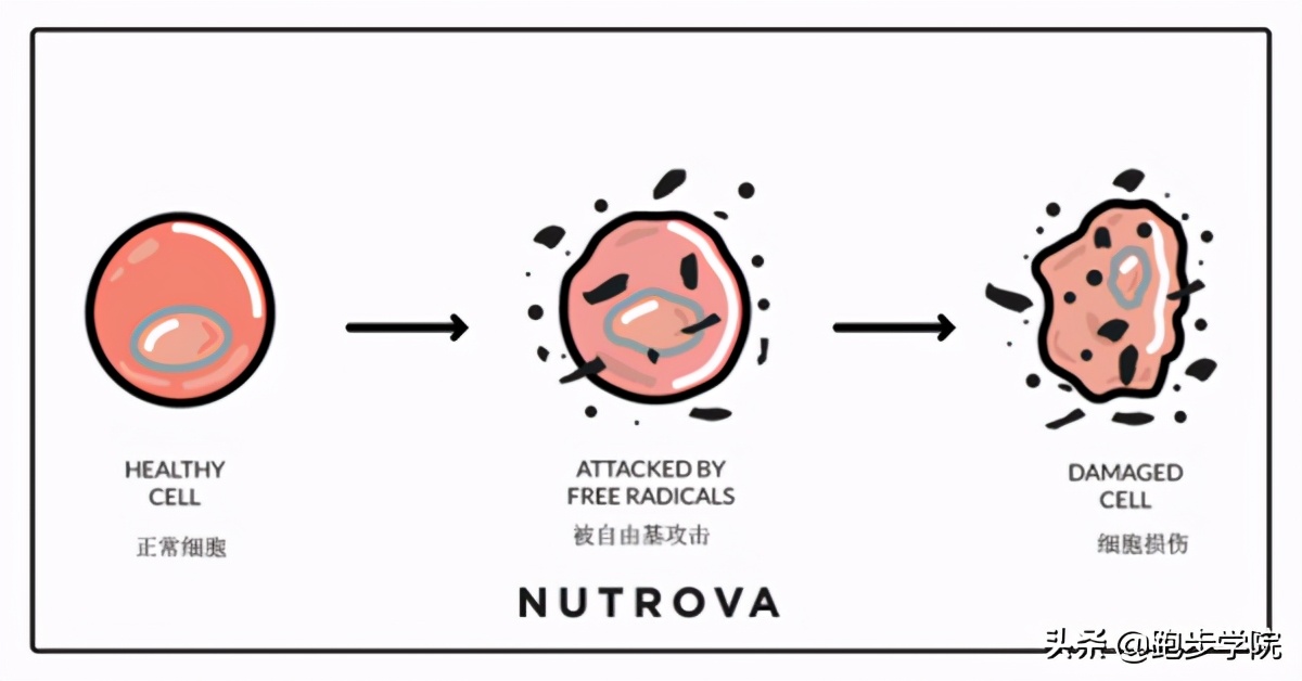 18岁运动时漏尿是怎么回事,运动不当引起茶色尿后自愈