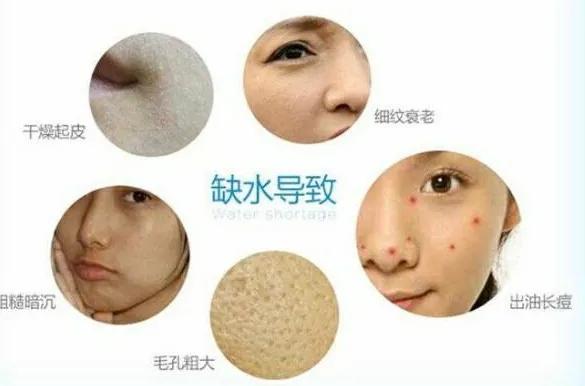 皮肤很干敷面膜也不管用怎么办,冬天皮肤干可以天天敷面膜吗