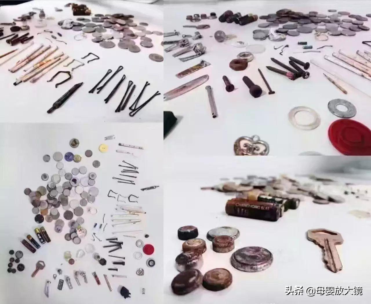 几个月宝宝吃东西被卡怎么办,大人被卡住急救方法能拍背吗