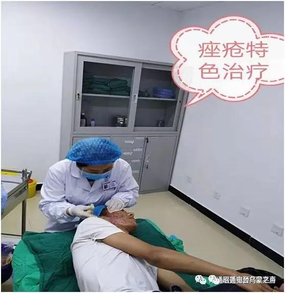 烧烫伤后有疤痕怎么办？《祝您健康》昭通市第二人民医院保刘俊医生支招