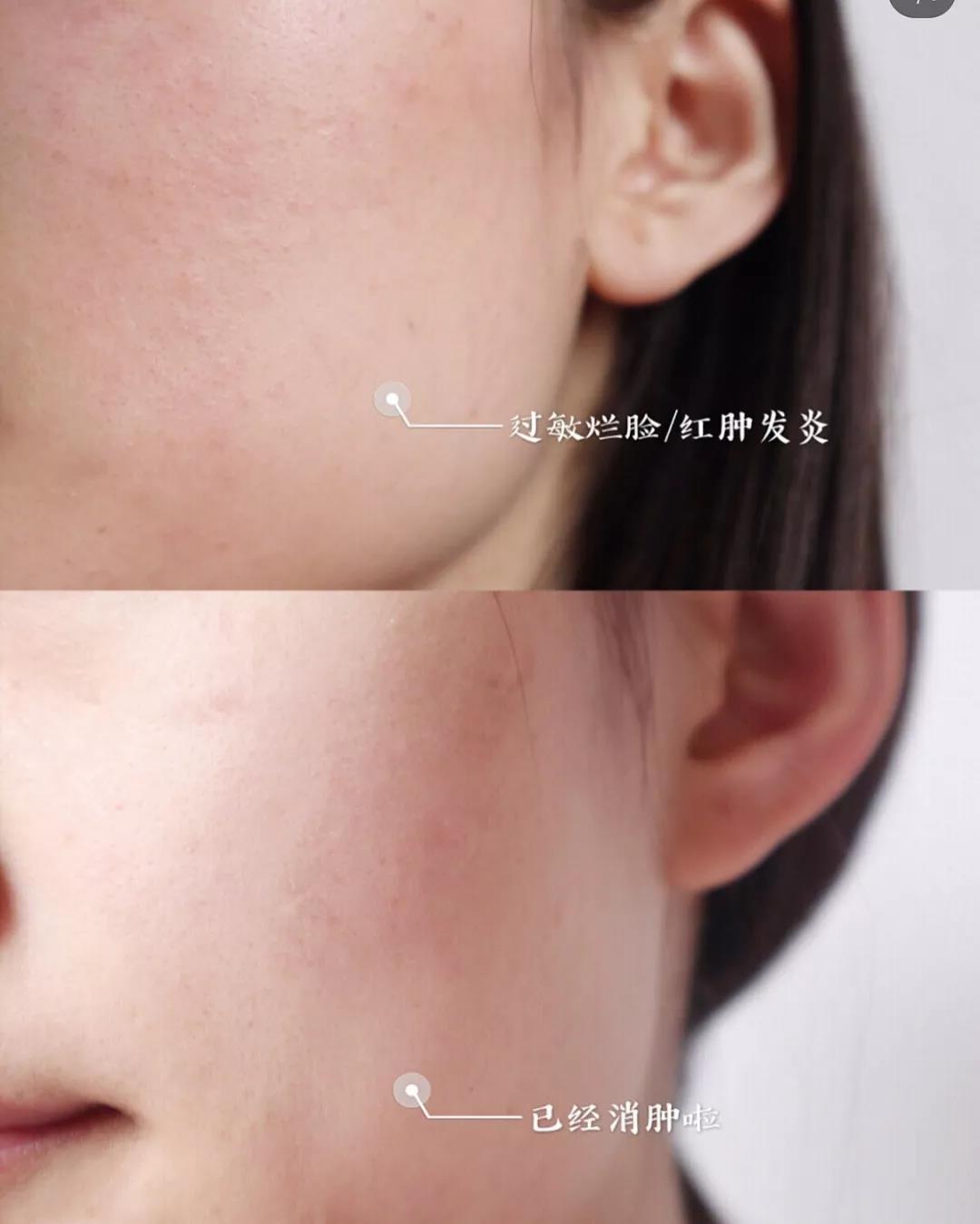 张馨予推荐的敏感肌面霜,张馨予晒出的一款面霜