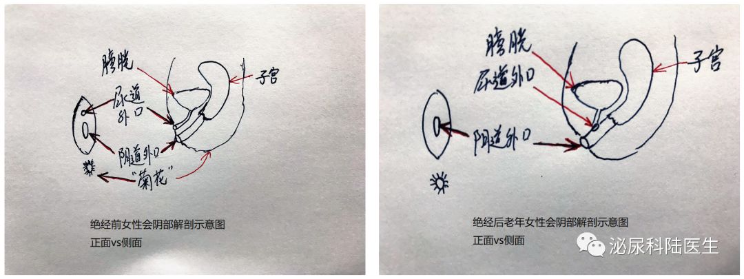 科普|老年女性百分百成功导尿秘笈来喽