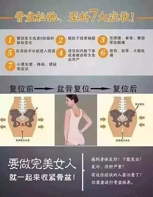 骨盆修复手法是不是智商税,做骨盆修复到底是不是智商税