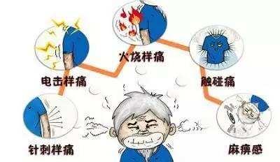 微血管减压术怎样,做微血管减压术权威医生排名