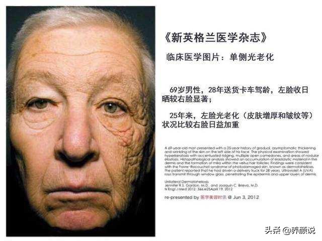 ​护肤品越用越多，肌肤状态急剧下滑，护肤品真的有效？