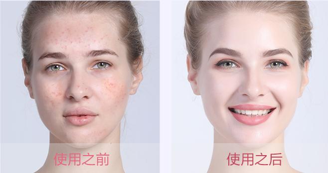 做美容的女人勇气可嘉,打了美容针的女人现在怎么样了