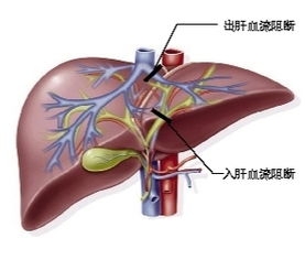 做手术时血是怎样止住,医生在做手术时如何止血