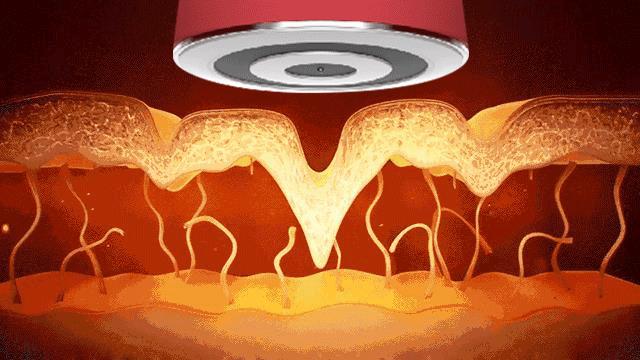 最新款射频美容仪,最好用的家用射频美容仪器