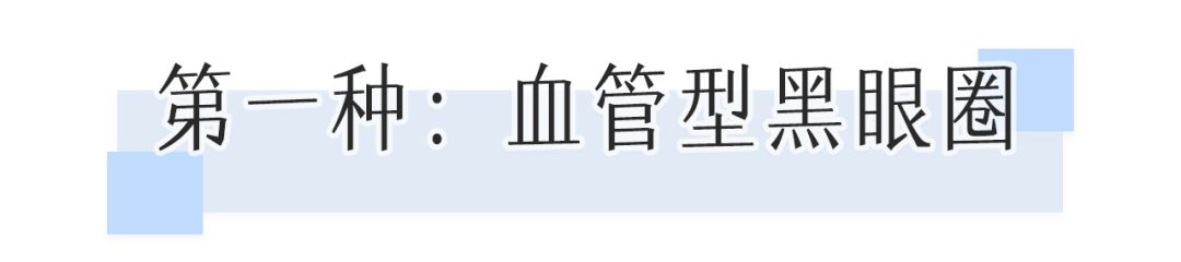 花了10800块去黑眼圈没效果,网上治疗黑眼圈靠谱么