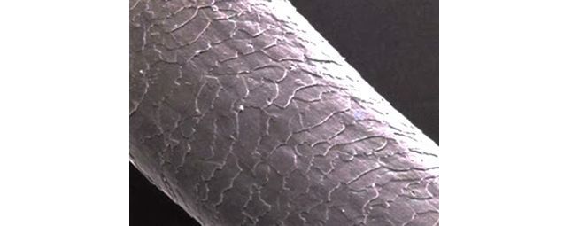 孕妇头发干枯毛躁怎么护理,老人头发干枯毛躁怎么护理