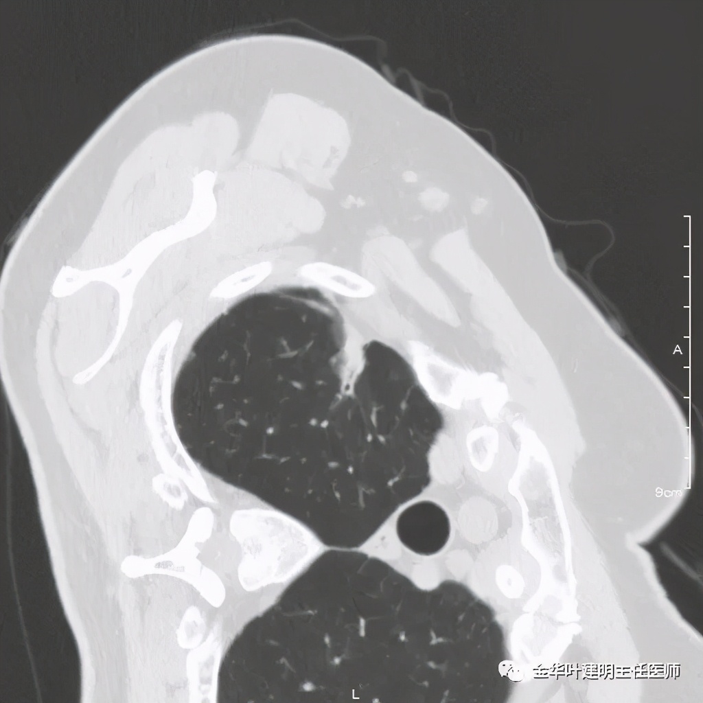 放个大招完整版教学,放个大招完整版前奏