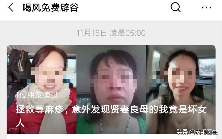 喝中药治疗荨麻疹反而严重了,防风能治荨麻疹吗