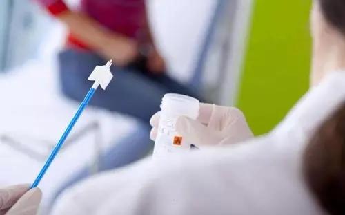 hpv和tct是有专门的试纸么,hpv和tct就是查白带吗
