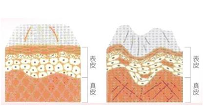 去皱纹轻松拥有好皮肤,皮肤皱纹多吃什么保养