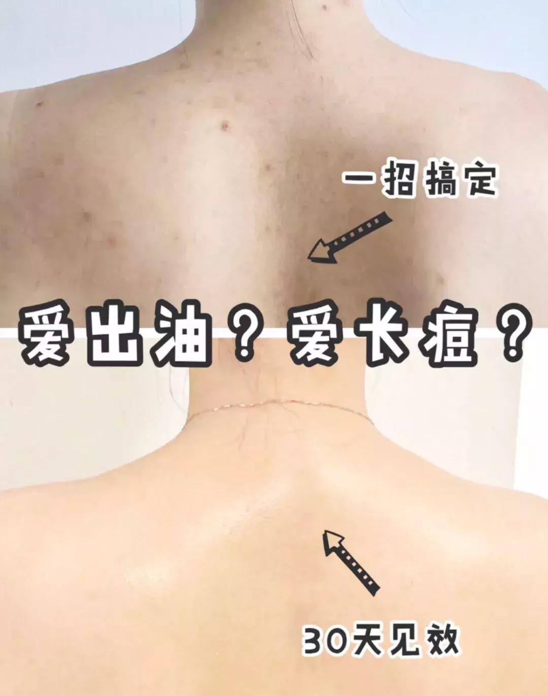 夏天就要心机露肤才更显瘦,又到了夏天露腿露肩的季节