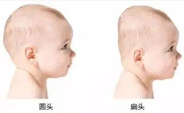 一岁宝宝睡偏头戴婴儿矫正头盔,七个月宝宝戴头盔多久能纠正头型