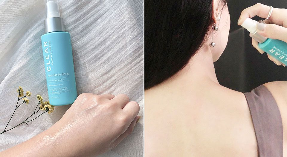 夏季起粉刺痘痘怎么调理,夏天为什么痘痘肌更容易长痘了