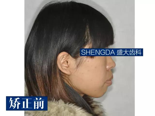 山西“爱马仕”级别齿科医院!get明星同款笑容