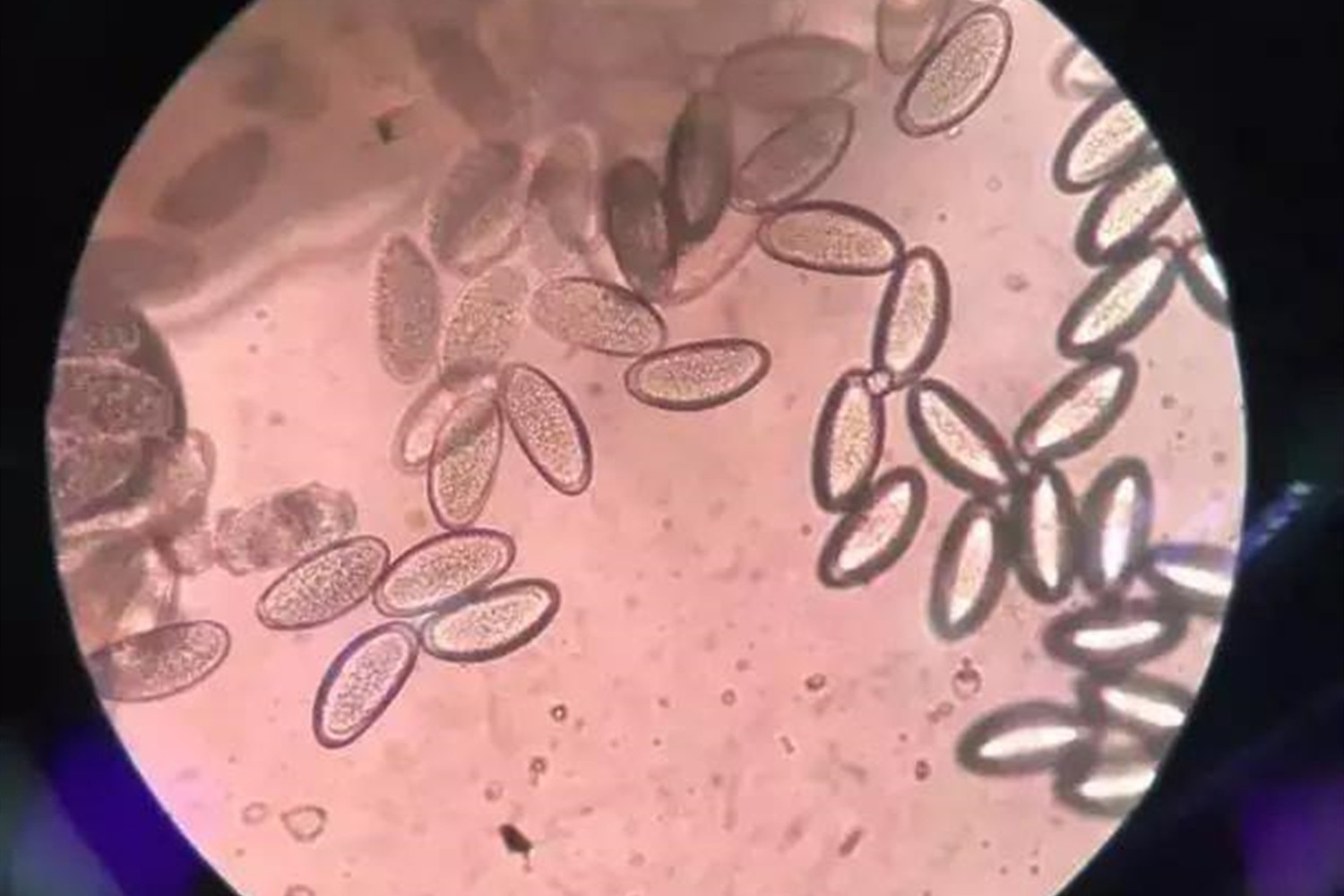 1岁宝宝半夜哭闹抓屁屁,四岁小孩总说屁痒