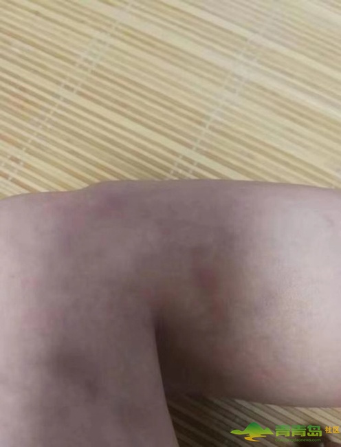 中联依山伴城房屋质量问题,中联依山伴城问题