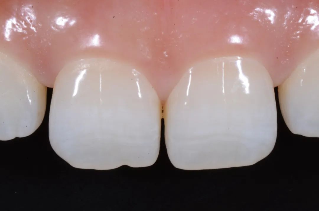 牙医从业感悟,牙医忠告11条