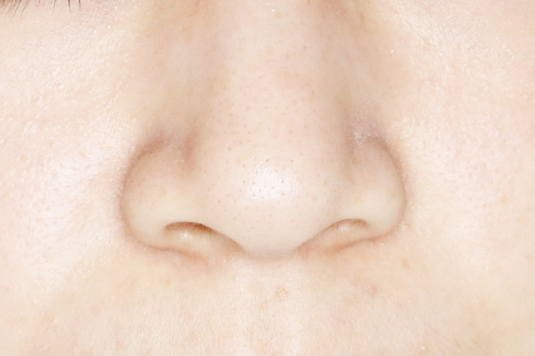 脸上皮肤需要定期做深度清洁吗,皮肤不好去医院检查什么