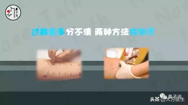 过敏性鼻炎查过敏原检测多少钱,化验血查过敏性鼻炎过敏原多少钱