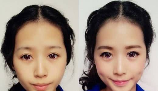 美瞳线针头粗的好还是细的好,美瞳线太细有必要加粗吗