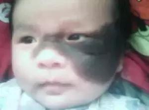 祛斑面诊必背知识点,要祛斑