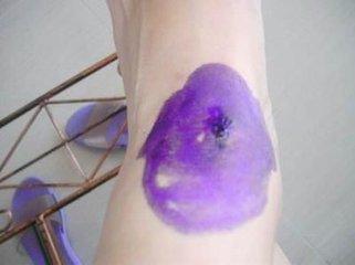 皮肤损伤，磕破和擦伤了，应该抹什么药，我来告诉你