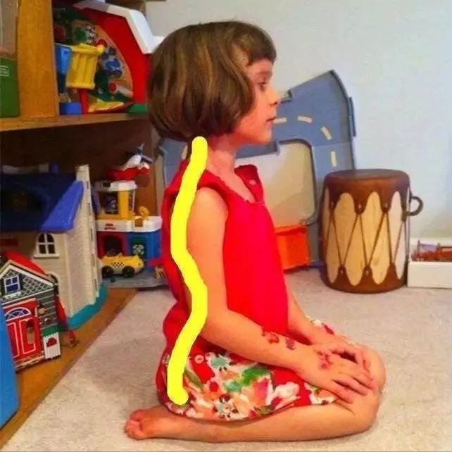 小儿歪头怎么治疗,小孩子面部倾斜怎么改正