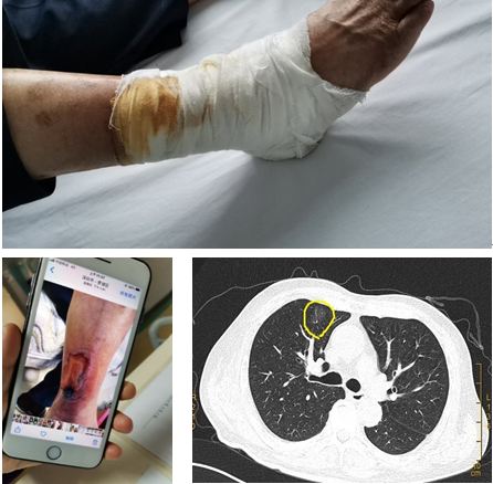 深圳第二人民医院疫情防控,深圳市第二人民医院抗疫情