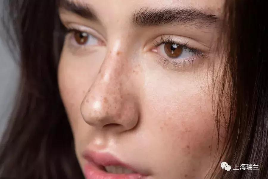 百“斑”刁难,“秒”速解忧