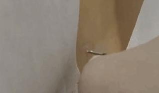 生孩子完全不疼的医院,生孩子不痛案例