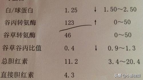 感冒会引起转氨酶胆红素偏高,感冒会影响肝功能的转氨酶高吗