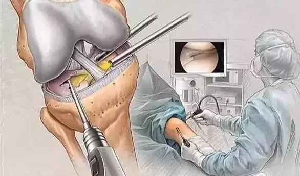 胳膊疼抬不起来理疗手法,胳膊疼的抬不起来怎样锻炼