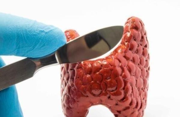 得了甲亢服用什么样中药效果好,治疗甲亢是用碘131好还是用手术好