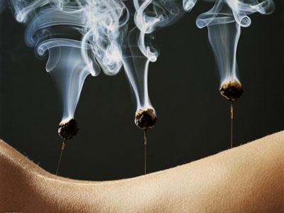 康复医学科拍了拍你,“冬病夏治”模式开启啦