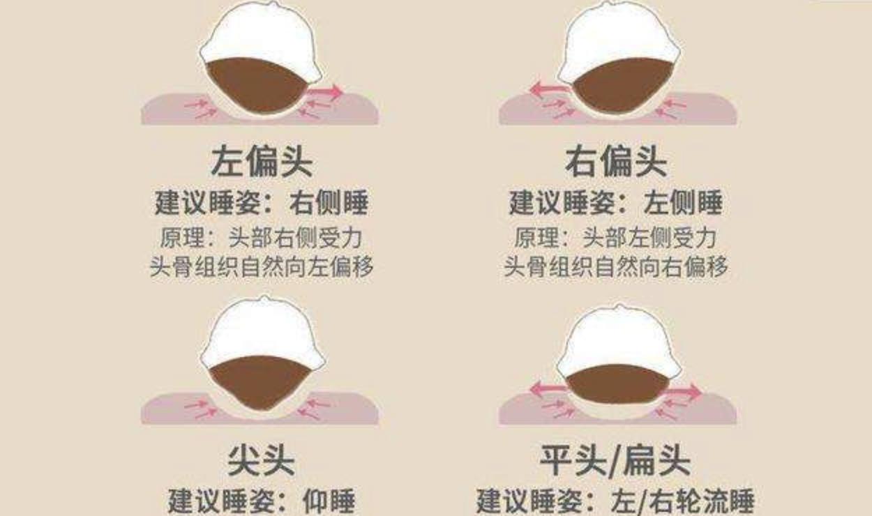 宝宝后脑勺高就是高智商的象征,有前脑勺后脑勺宝宝聪明吗