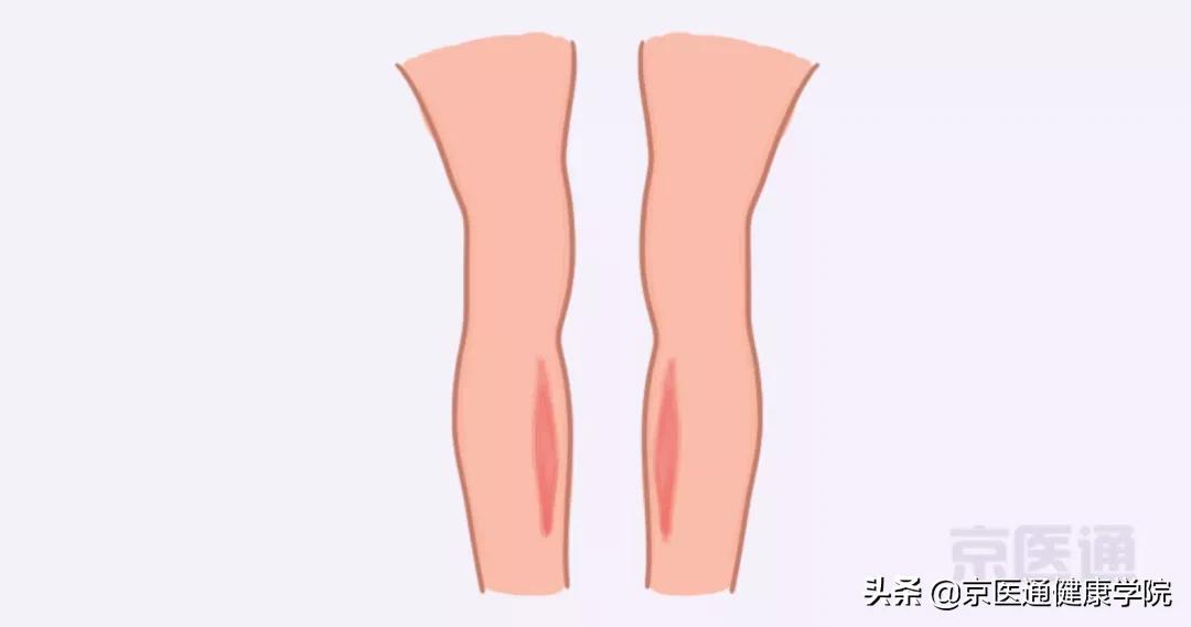 膝盖疼、腿疼、脚疼,5种跑步损伤,专家教你处理